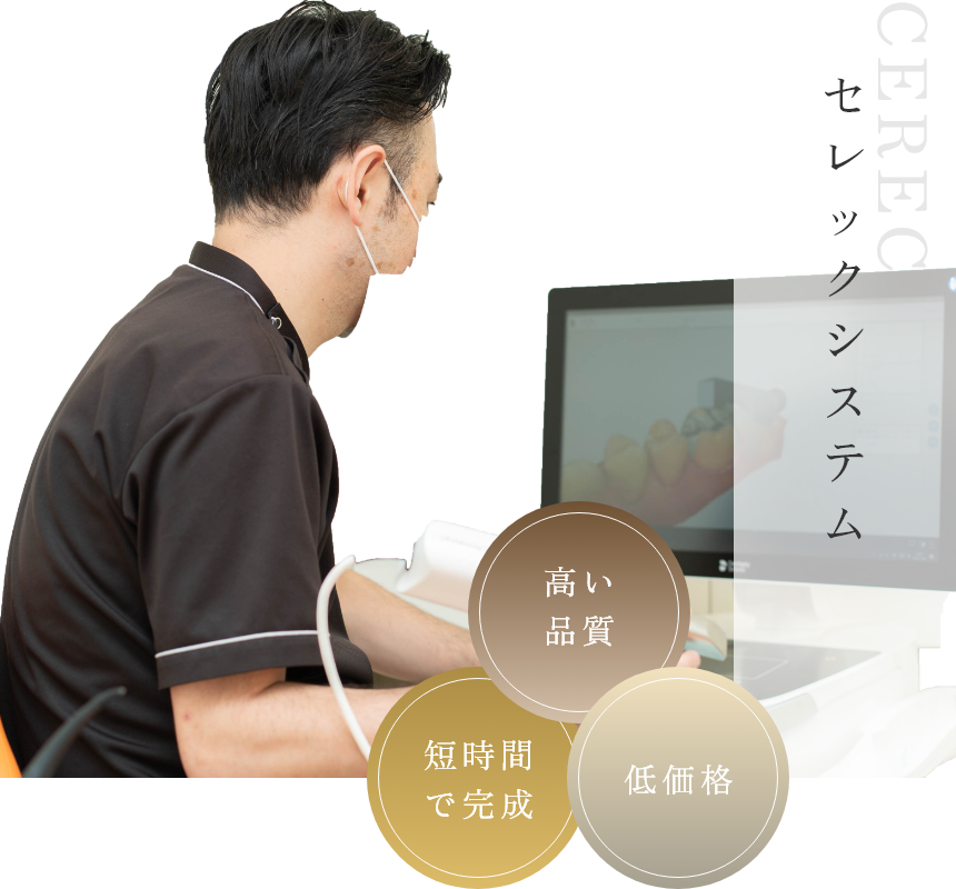 セレックシステムの特徴